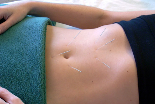 Lisa Pate Acupuncture